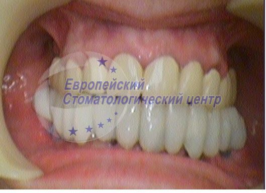 Пацієнт 7