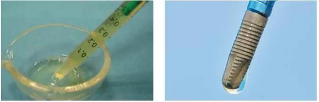 Застосування PRGF®-ENDORET® для прискорення регенерації кістки і м’яких тканин в постекстракційних альвеолах